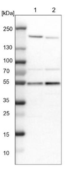 Western Blot: smu1 Antibody [NBP1-88522] - Lane 1: NIH-3T3 cell lysate (Mouse embryonic fibroblast cells)<br/>Lane 2: NBT-II cell lysate (Rat Wistar bladder tumour cells)