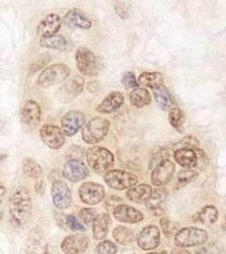 Detection of human QSER1 by immunohistochemistry.