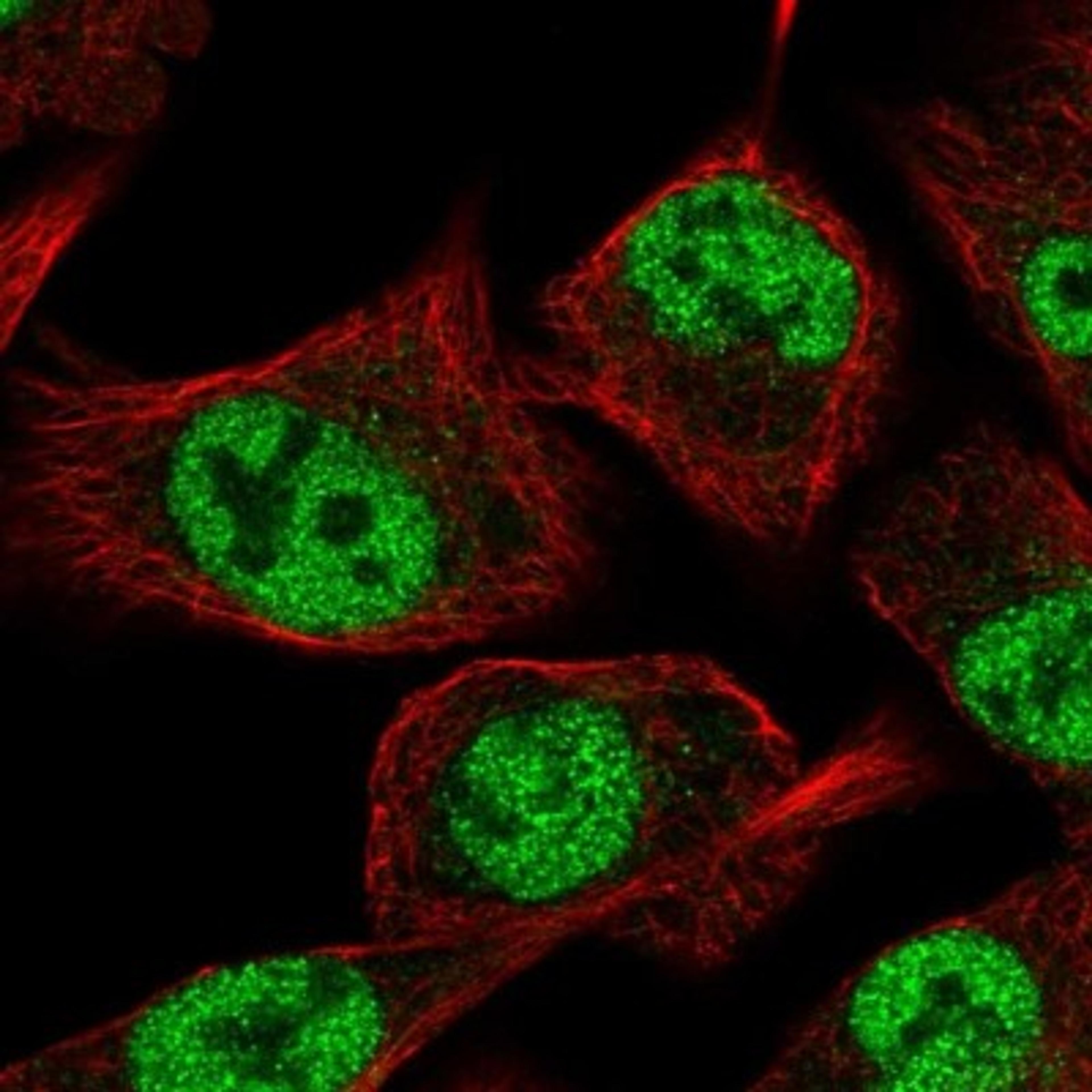 Immunocytochemistry/Immunofluorescence: GLIS3 Antibody [NBP2-33787] - Immunofluorescent staining of human cell line A-549 shows positivity in nucleus but excluded from the nucleoli.