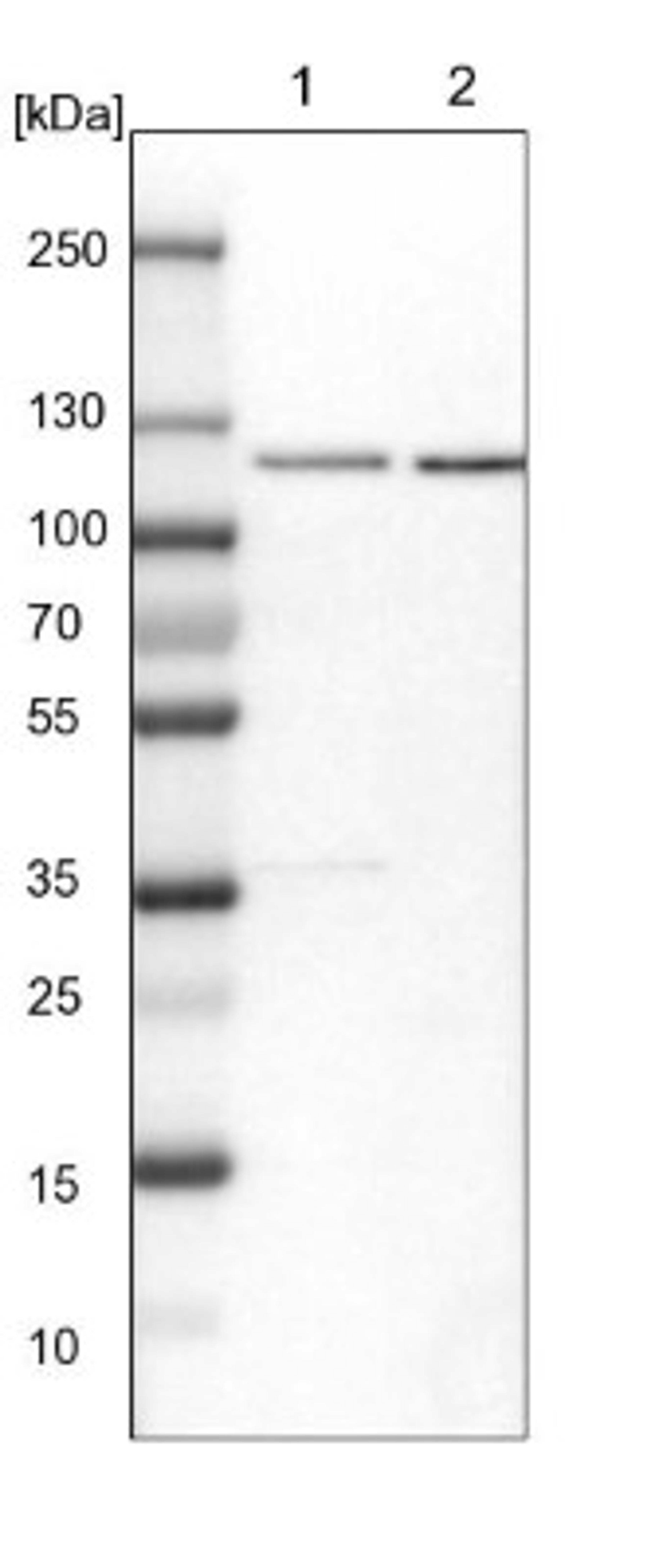 Western Blot: RBM15 Antibody [NBP1-82465] - Lane 1: NIH-3T3 cell lysate (Mouse embryonic fibroblast cells)<br/>Lane 2: NBT-II cell lysate (Rat Wistar bladder tumour cells)