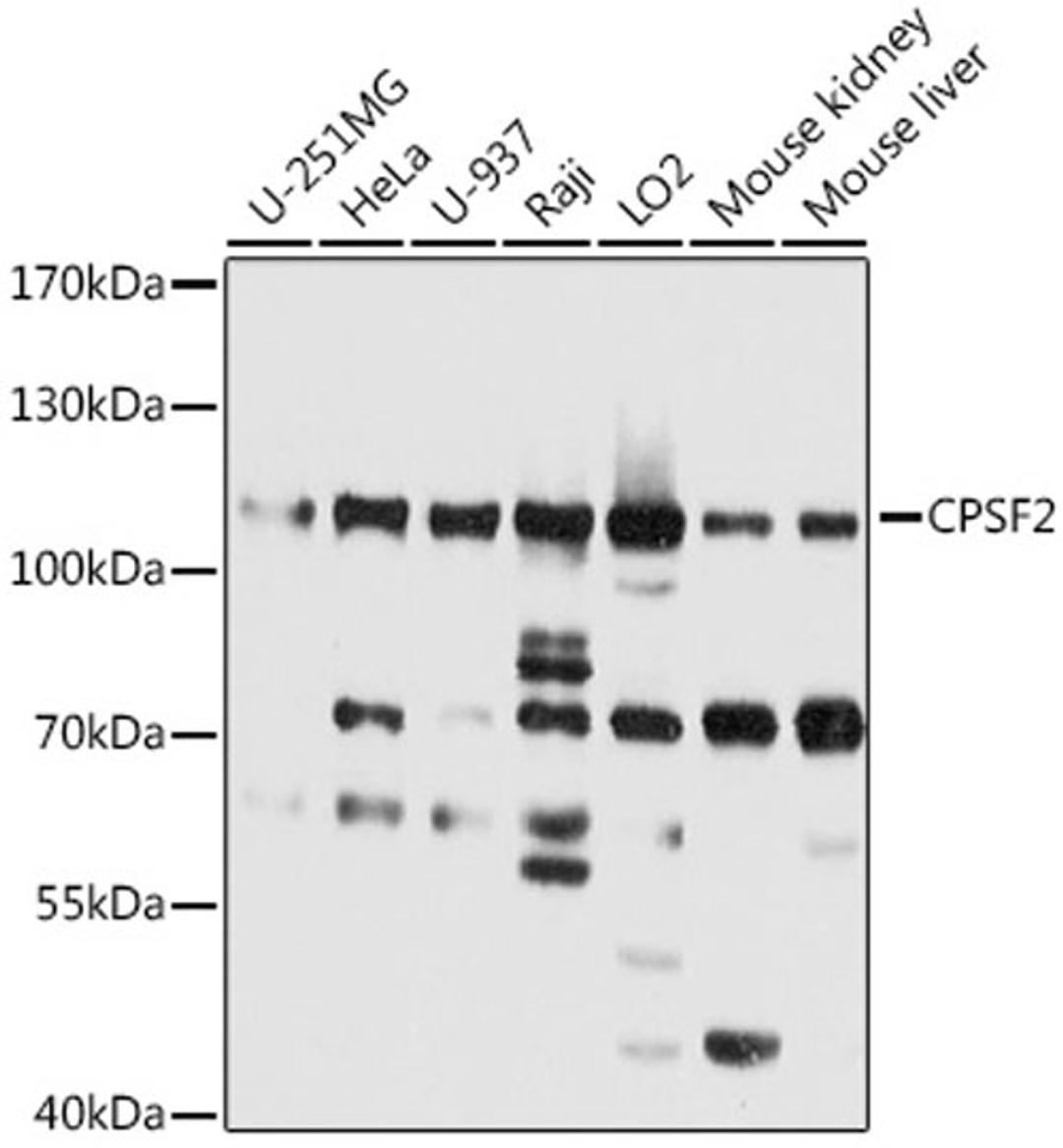 Western blot - CPSF2 antibody (A9297)