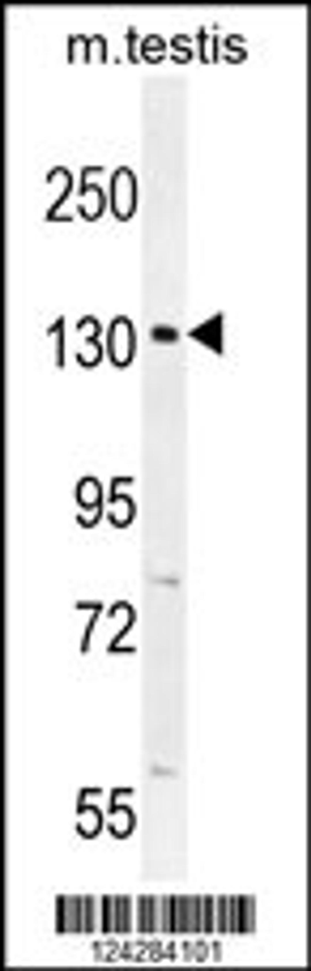 Western blot analysis in mouse testis tissue lysates (35ug/lane).