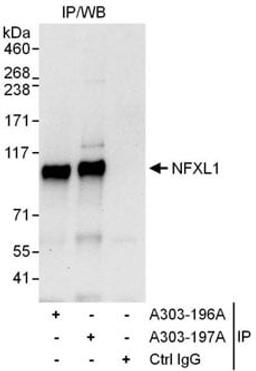 Detection of human NFXL1 by western blot of immunoprecipitates.