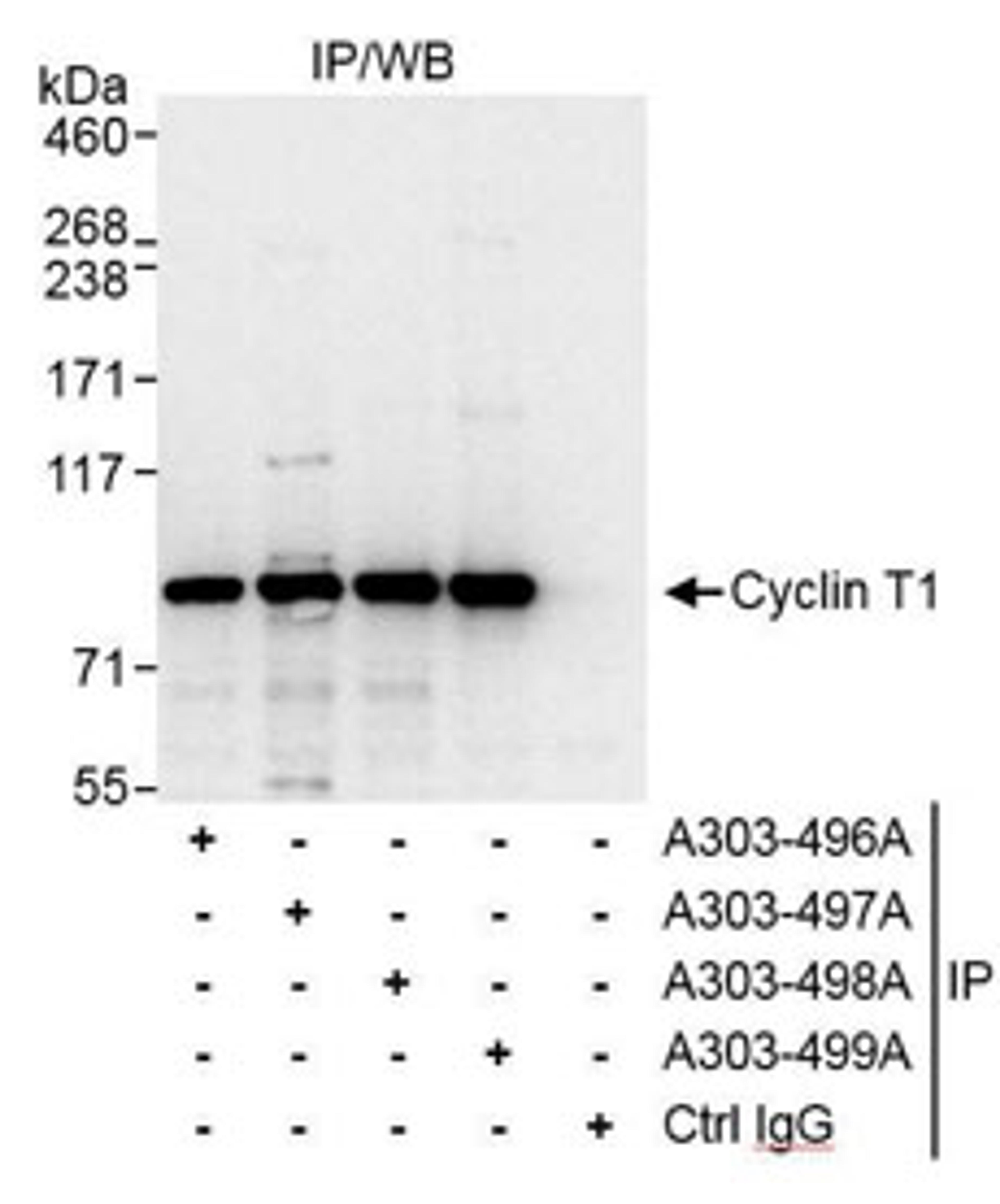 Detection of human Cyclin T1 by western blot of immunoprecipitates.