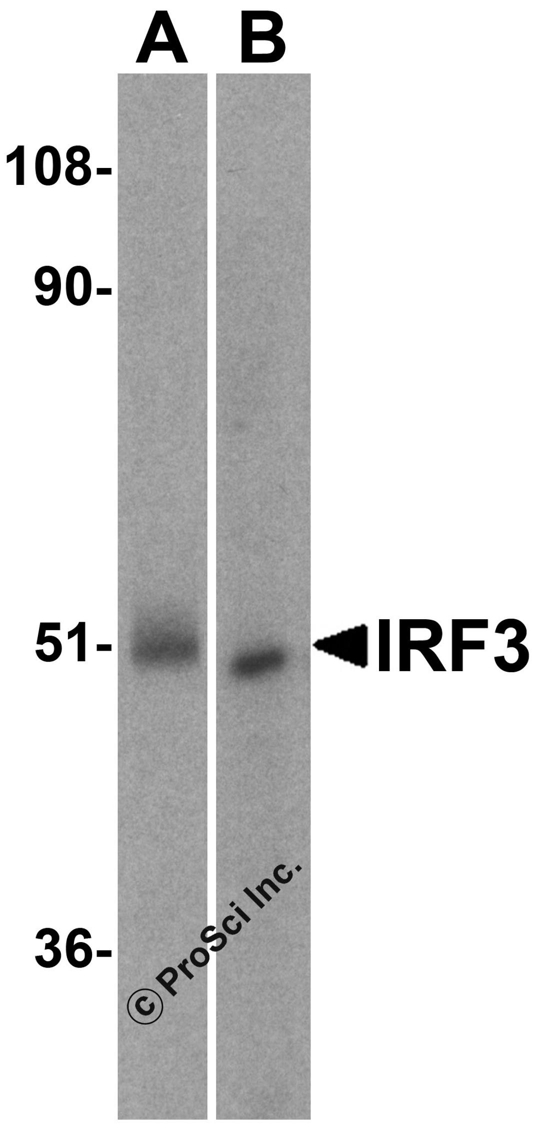 Western blot analysis of IRF3 in (A) human kidney and (B) rat kidney lysate with IRF3 antibody at 1 μg/mL..