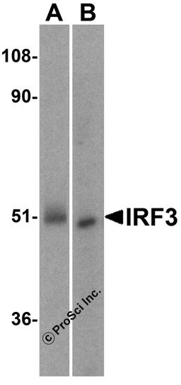 Western blot analysis of IRF3 in (A) human kidney and (B) rat kidney lysate with IRF3 antibody at 1 μg/mL..