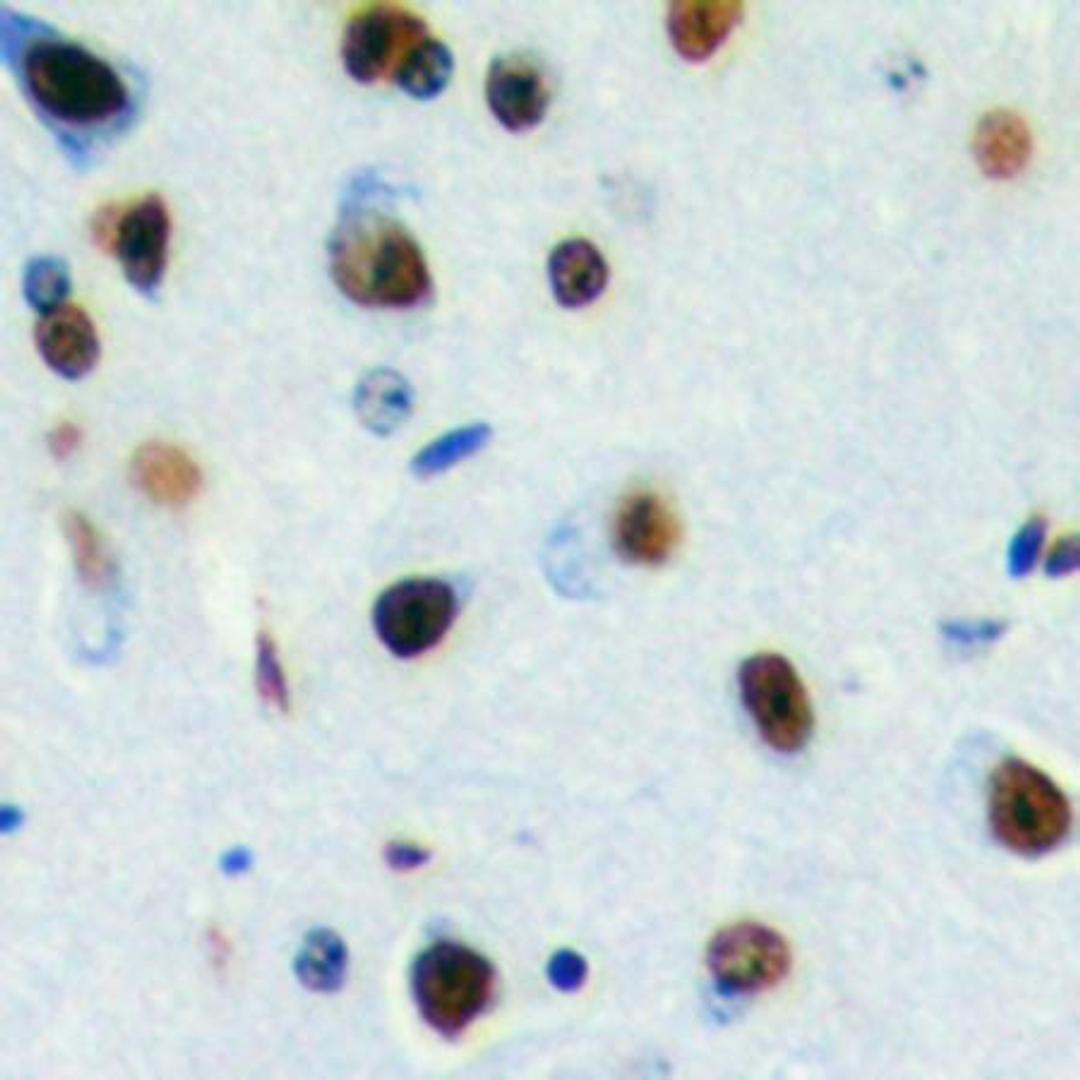 Immunohistochemical analysis of formalin-fixed and paraffin-embedded human brain tissue using DLX3 antibody