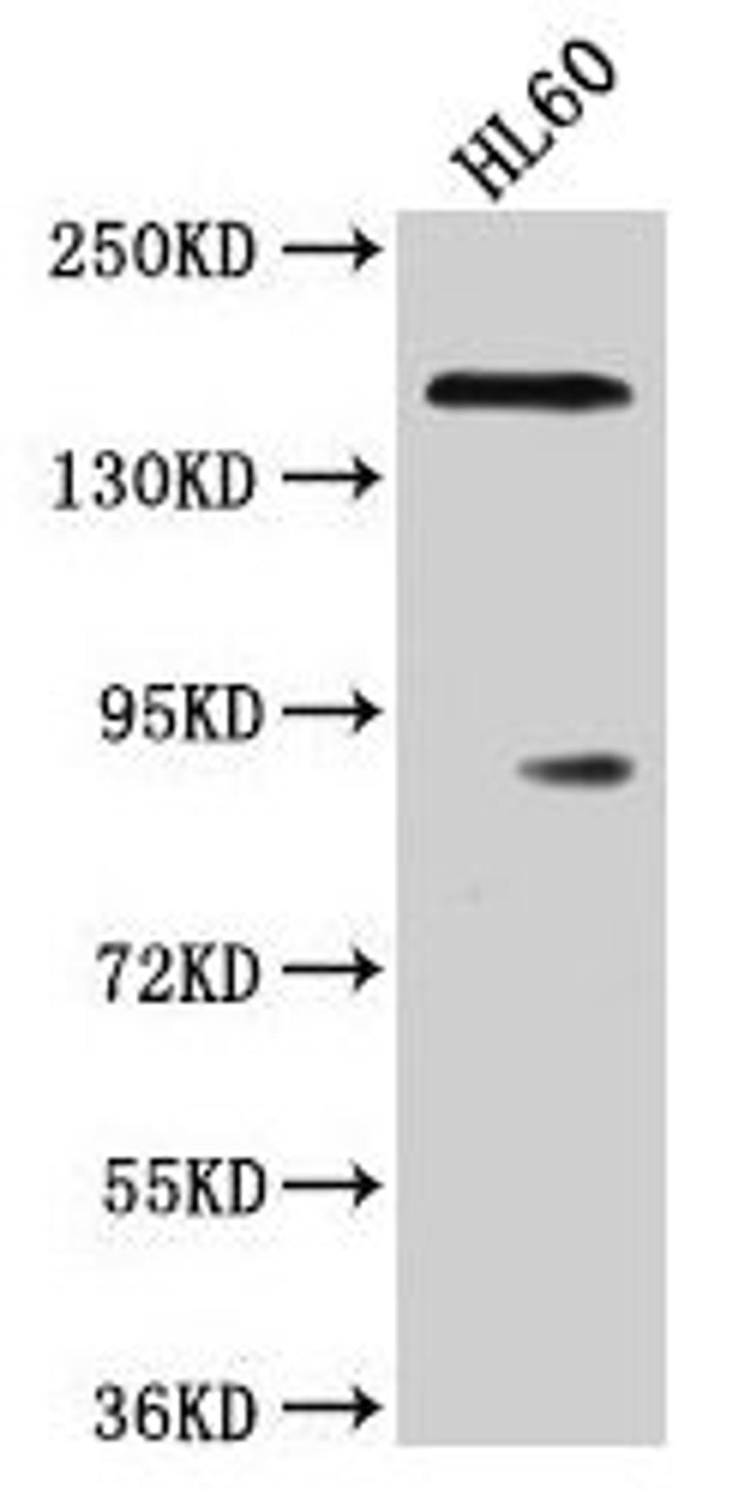 Western Blot. Positive WB detected in: HL60 whole cell lysate. All lanes: ROCK1 antibody at 1:2000. Secondary. Goat polyclonal to rabbit IgG at 1/50000 dilution. Predicted band size: 159 kDa. Observed band size: 159 kDa