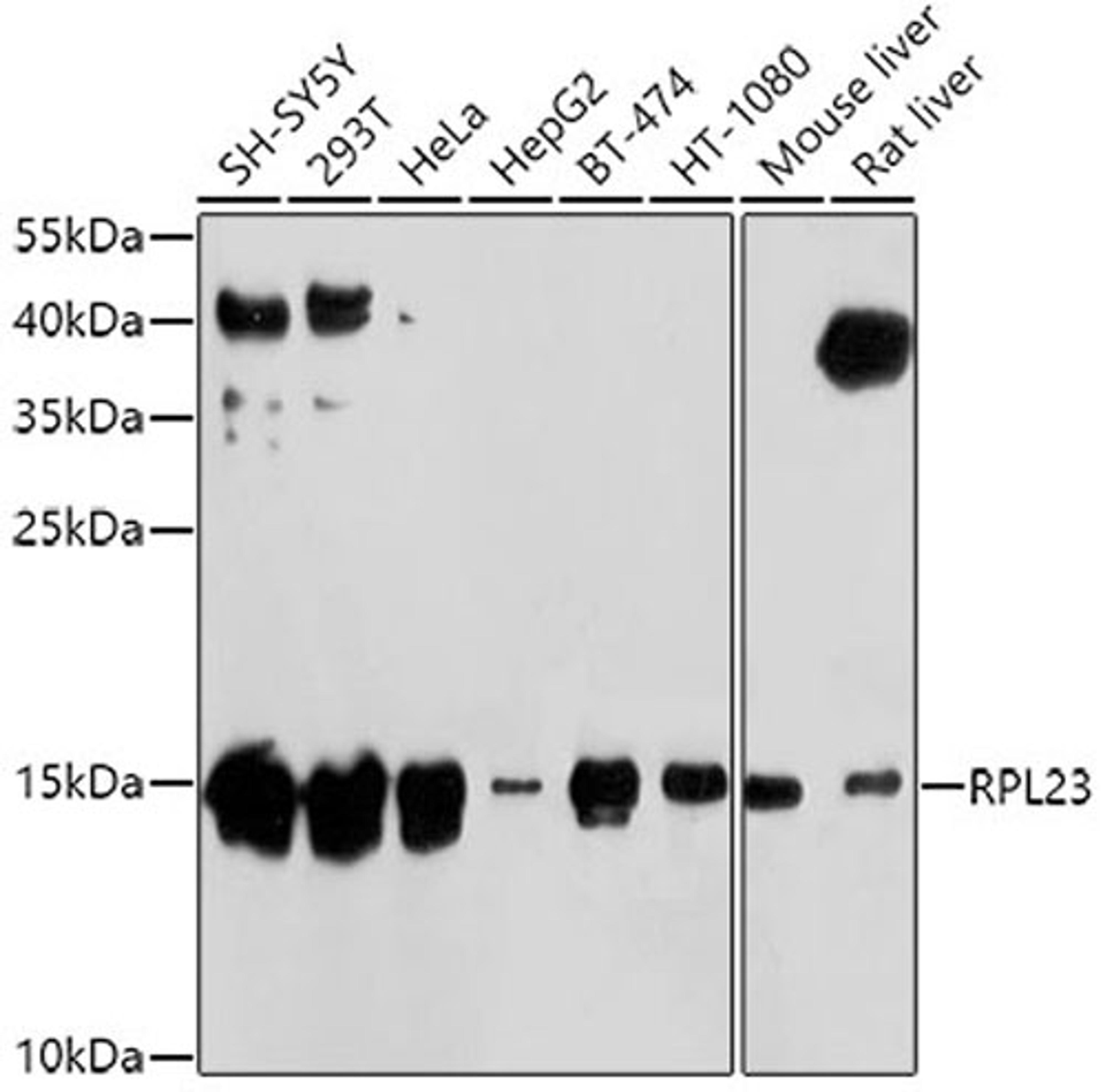 Western blot - RPL23 antibody (A4292)