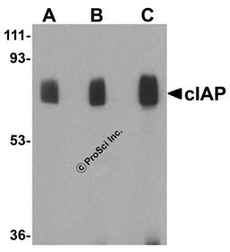 Western blot analysis of c-IAP in human lung lysate with c-IAP antibody at 1 (lane A), 2 (lane B), and 4 (lane C) μg/mL, respectively.