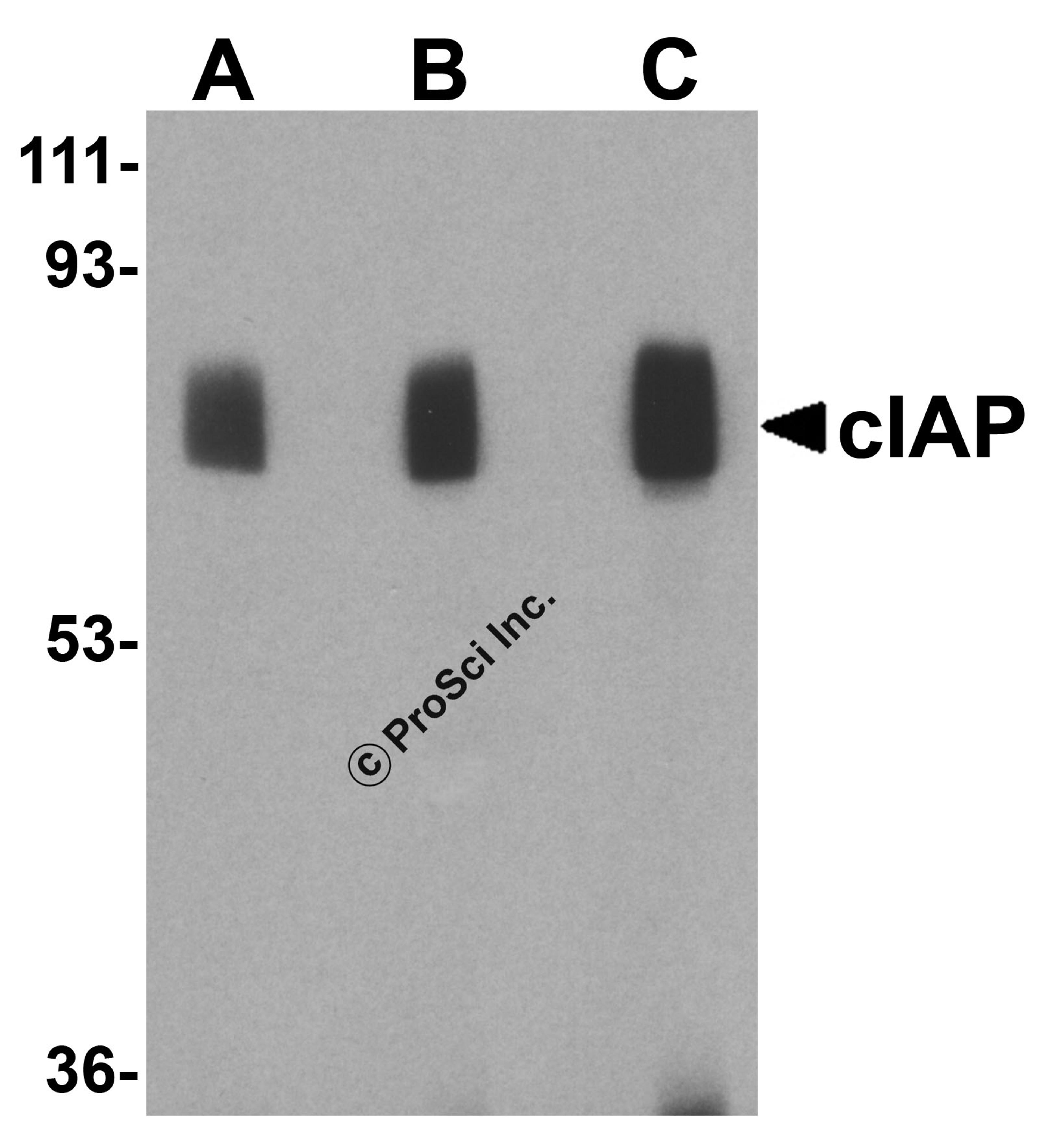 Western blot analysis of c-IAP in human lung lysate with c-IAP antibody at 1 (lane A), 2 (lane B), and 4 (lane C) μg/mL, respectively.