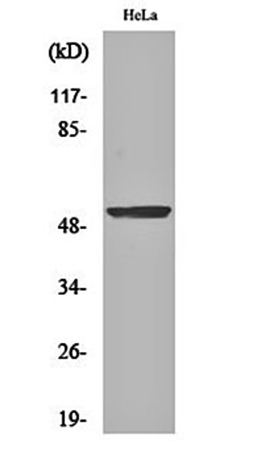 Western blot analysis of Hela cell lysates using BMP-3A antibody