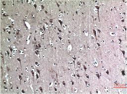 Immunohistochemical analysis of paraffin-embedded Human Brain Tissue using Beclin-1 Mouse mAb diluted at 1:200.