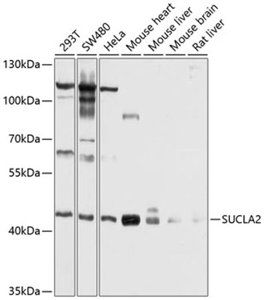 Western blot - SUCLA2 antibody (A10040)