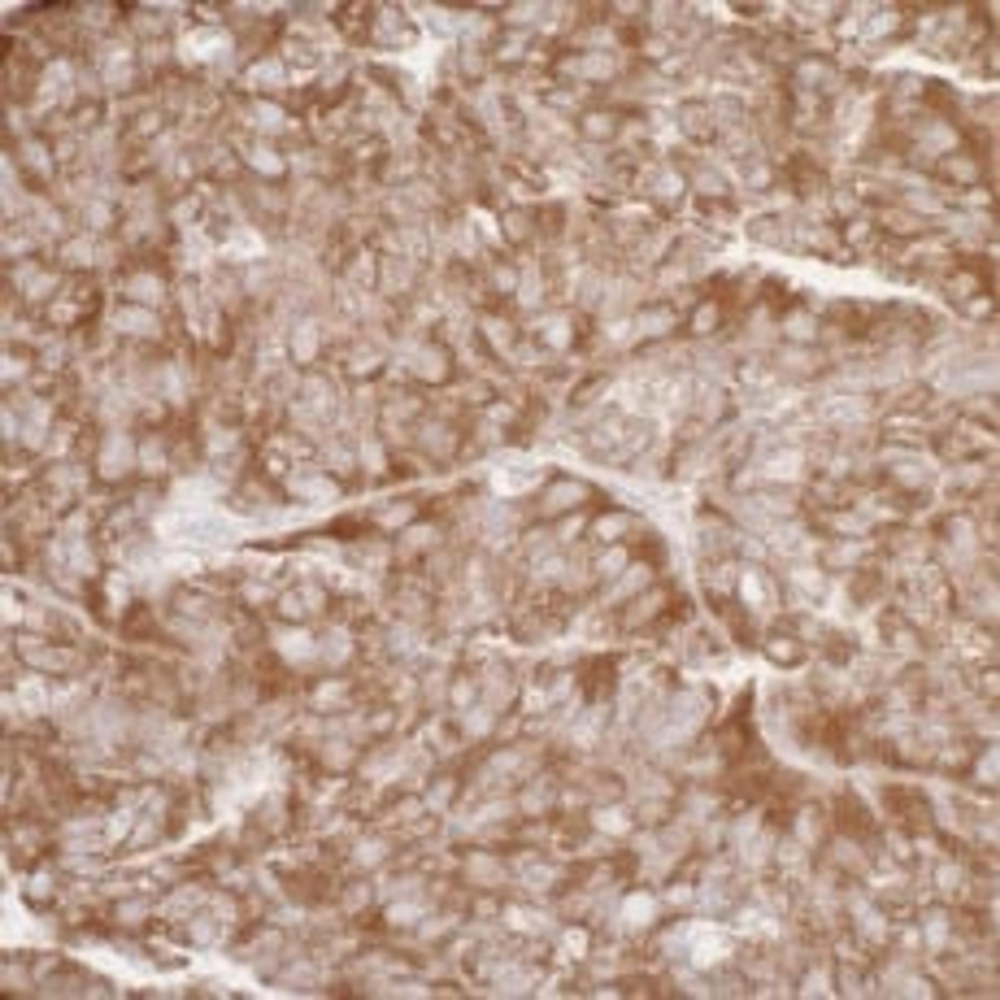 Detection of human RPL7 by immunohistochemistry.