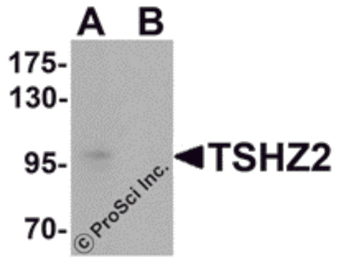 Western blot analysis of TSHZ2 in A-20 cell lysate with TSHZ2 antibody at 1 &#956;g/mL in (A) the absence and (B) the presence of blocking peptide.