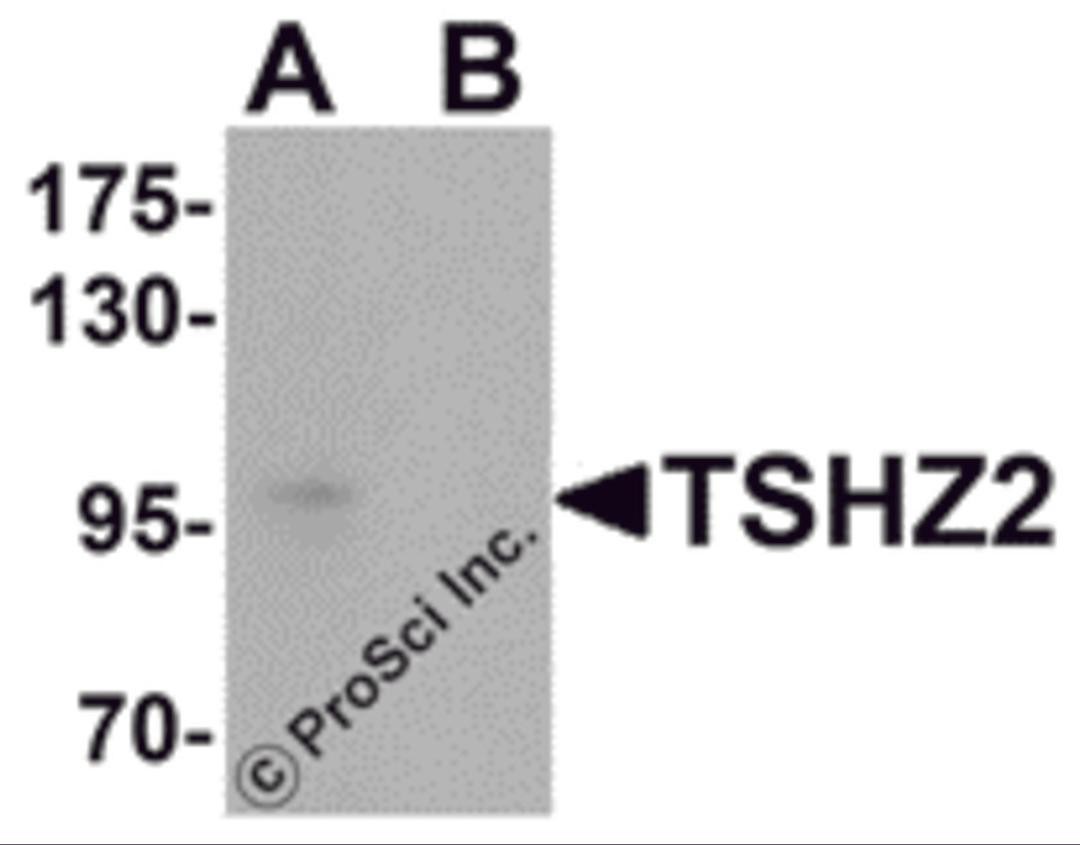 Western blot analysis of TSHZ2 in A-20 cell lysate with TSHZ2 antibody at 1 μg/mL in (A) the absence and (B) the presence of blocking peptide.