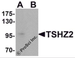 Western blot analysis of TSHZ2 in A-20 cell lysate with TSHZ2 antibody at 1 μg/mL in (A) the absence and (B) the presence of blocking peptide.
