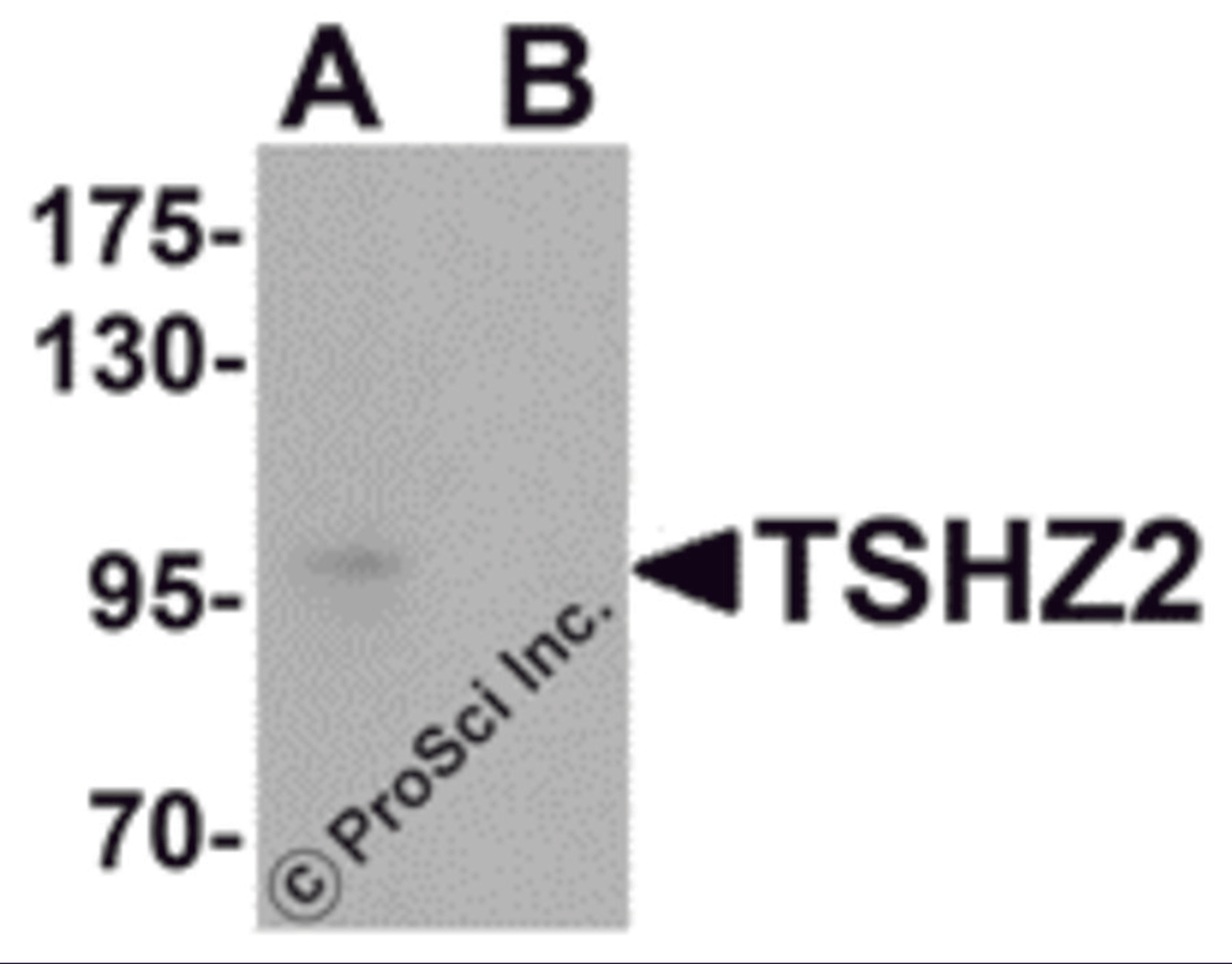 Western blot analysis of TSHZ2 in A-20 cell lysate with TSHZ2 antibody at 1 μg/mL in (A) the absence and (B) the presence of blocking peptide.