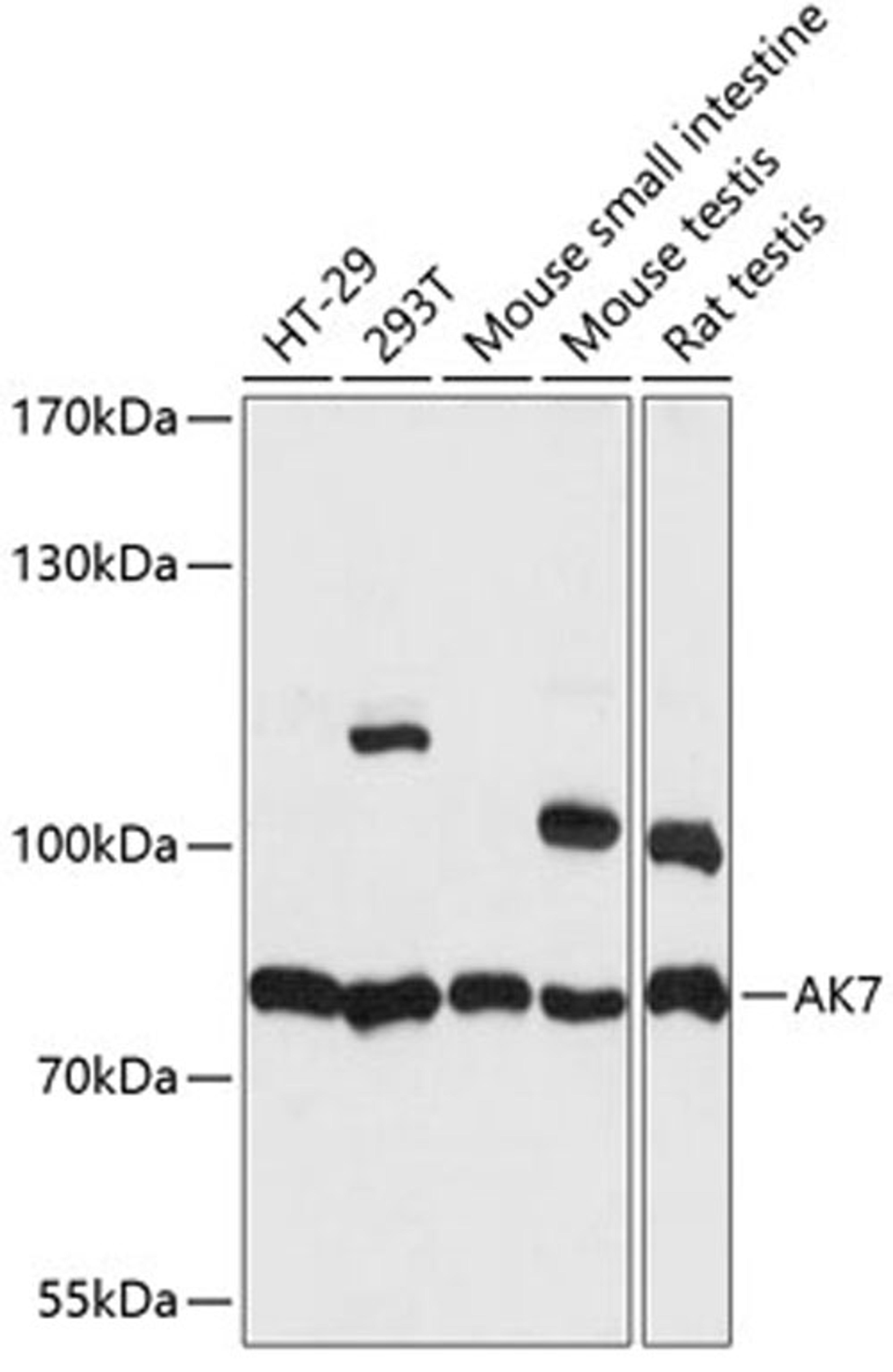 Western blot - AK7 antibody (A14600)