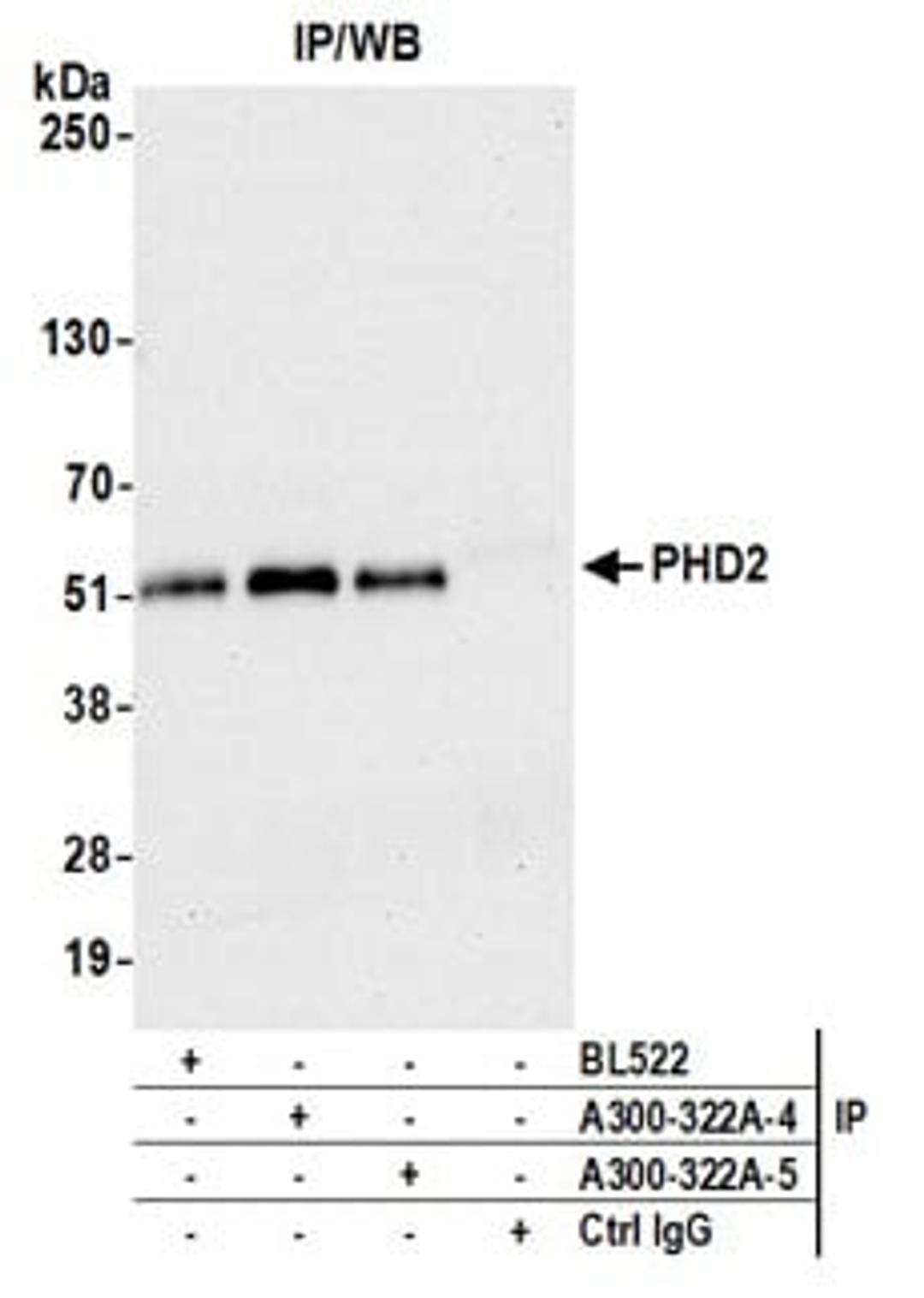 Detection of human PHD2 by western blot of immunoprecipitates.