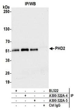 Detection of human PHD2 by western blot of immunoprecipitates.