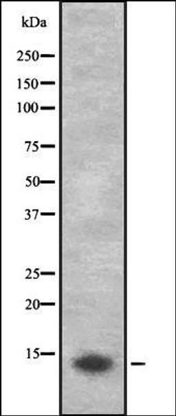 Western blot analysis of HEK293 cells using Cytochrome P450 3A43 antibody