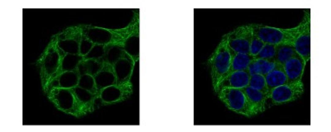 Immunocytochemistry/Immunofluorescence: Vinexin Antibody [NBP2-20861] - Sample: HepG2 cells were fixed in 4% paraformaldehyde at RT for 15 min. Green: SORBS3 protein stained by Vinexin antibody, Internal diluted at 1:500. Blue: Hoechst 33343 staining.