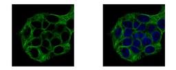 Immunocytochemistry/Immunofluorescence: Vinexin Antibody [NBP2-20861] - Sample: HepG2 cells were fixed in 4% paraformaldehyde at RT for 15 min. Green: SORBS3 protein stained by Vinexin antibody, Internal diluted at 1:500. Blue: Hoechst 33343 staining.