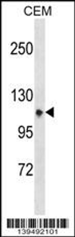 Western blot analysis in CEM cell line lysates (35ug/lane).