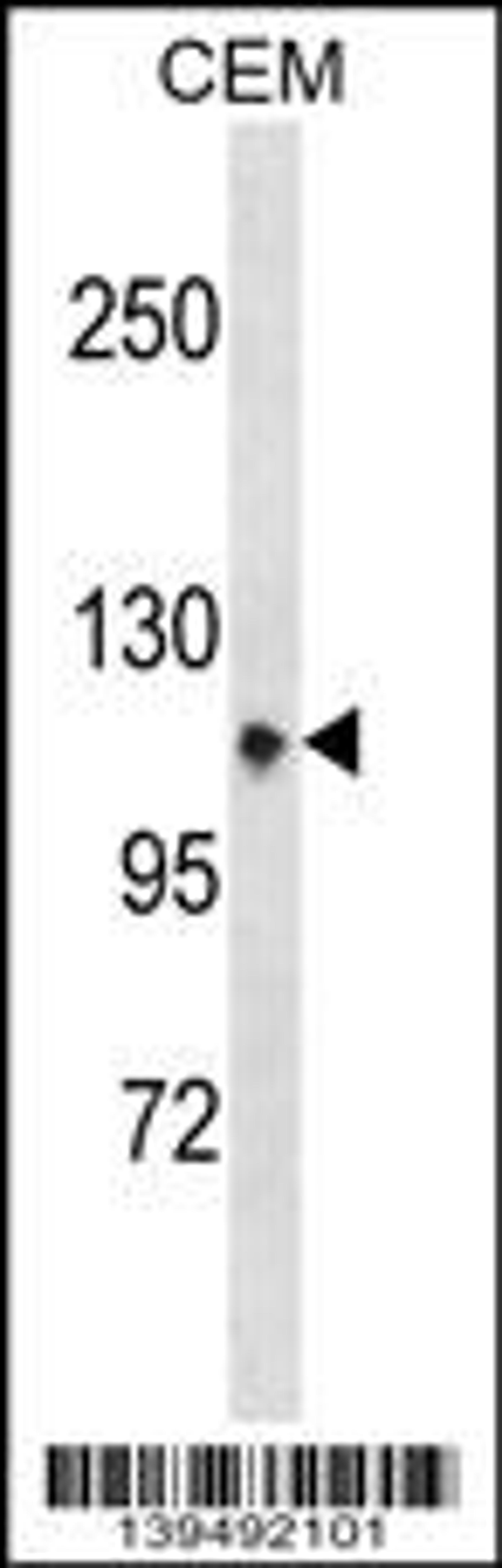 Western blot analysis in CEM cell line lysates (35ug/lane).