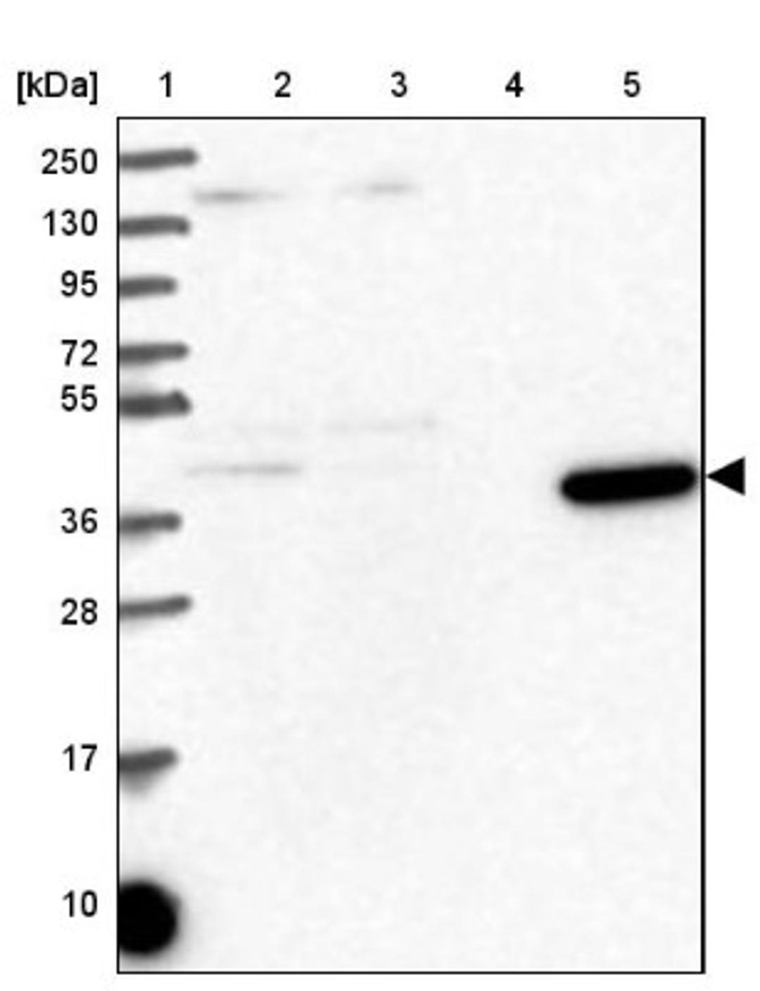 Western Blot: Methionine Aminopeptidase 1/METAP1 Antibody [NBP2-38375] - Lane 1: Marker [kDa] 250, 130, 95, 72, 55, 36, 28, 17, 10<br/>Lane 2: RT-4<br/>Lane 3: U-251 MG<br/>Lane 4: Human Plasma<br/>Lane 5: Liver