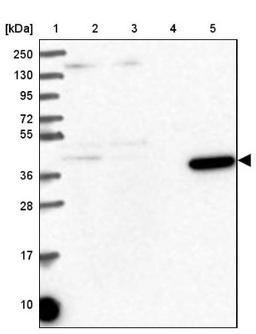 Western Blot: Methionine Aminopeptidase 1/METAP1 Antibody [NBP2-38375] - Lane 1: Marker [kDa] 250, 130, 95, 72, 55, 36, 28, 17, 10<br/>Lane 2: RT-4<br/>Lane 3: U-251 MG<br/>Lane 4: Human Plasma<br/>Lane 5: Liver