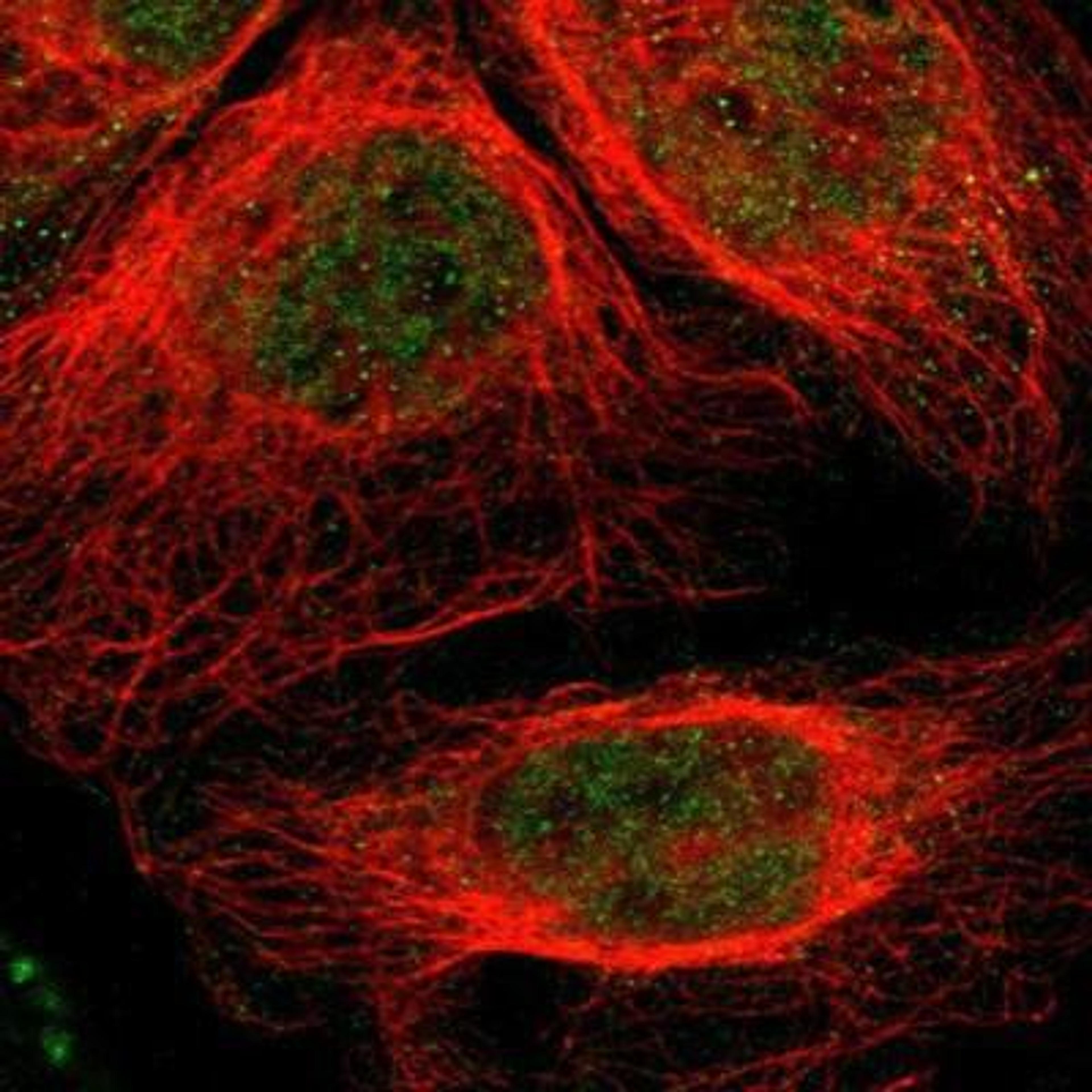 Immunocytochemistry/Immunofluorescence: Myosin 18B Antibody [NBP1-89967] - Staining of human cell line A-431 shows positivity in nucleus but not nucleoli & cytoplasm.