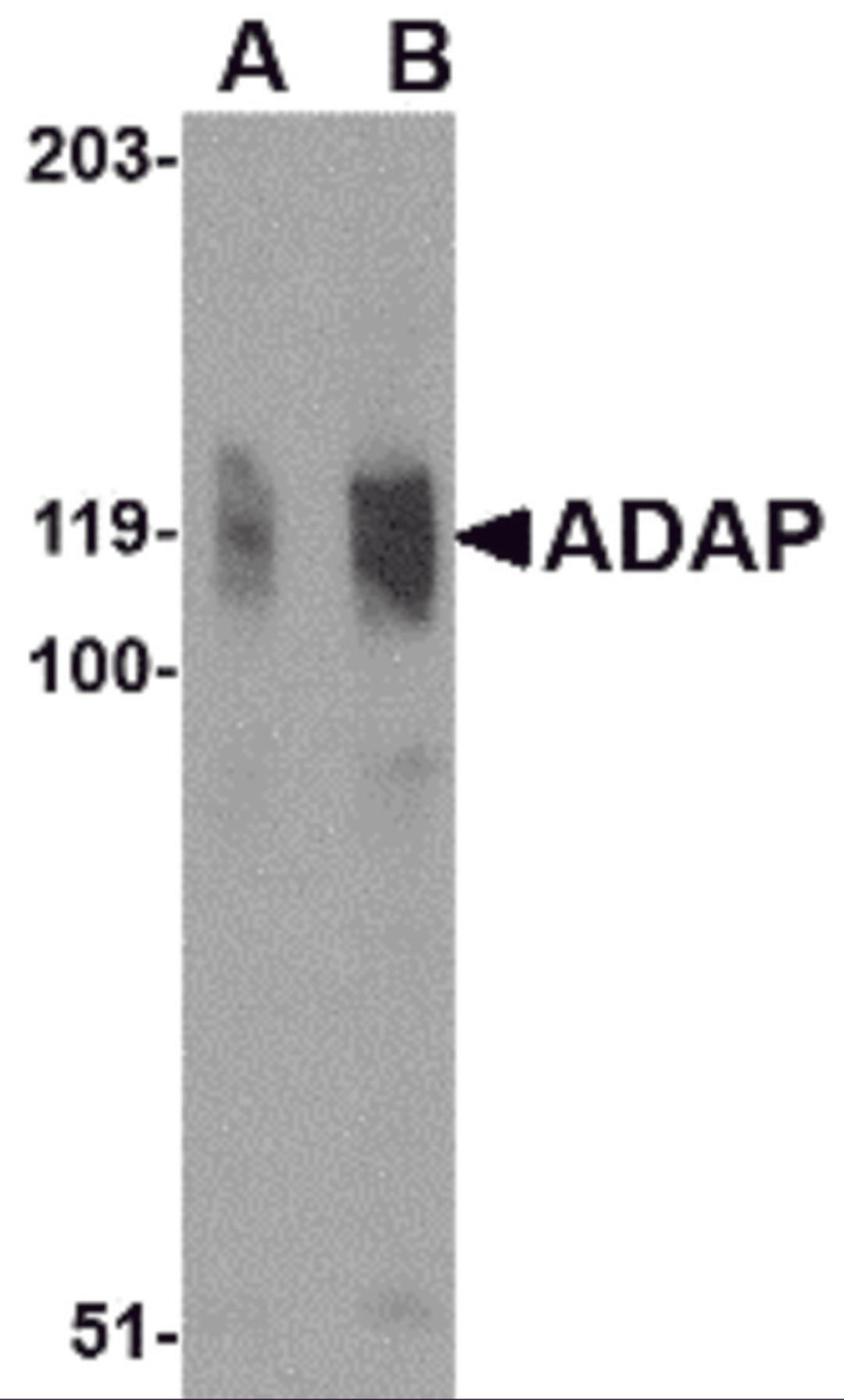 Western blot analysis of ADAP in K562 cell lysate with ADAP antibody at (A) 0.5 and (B) 1 μg/mL.