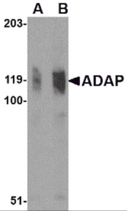 Western blot analysis of ADAP in K562 cell lysate with ADAP antibody at (A) 0.5 and (B) 1 μg/mL.
