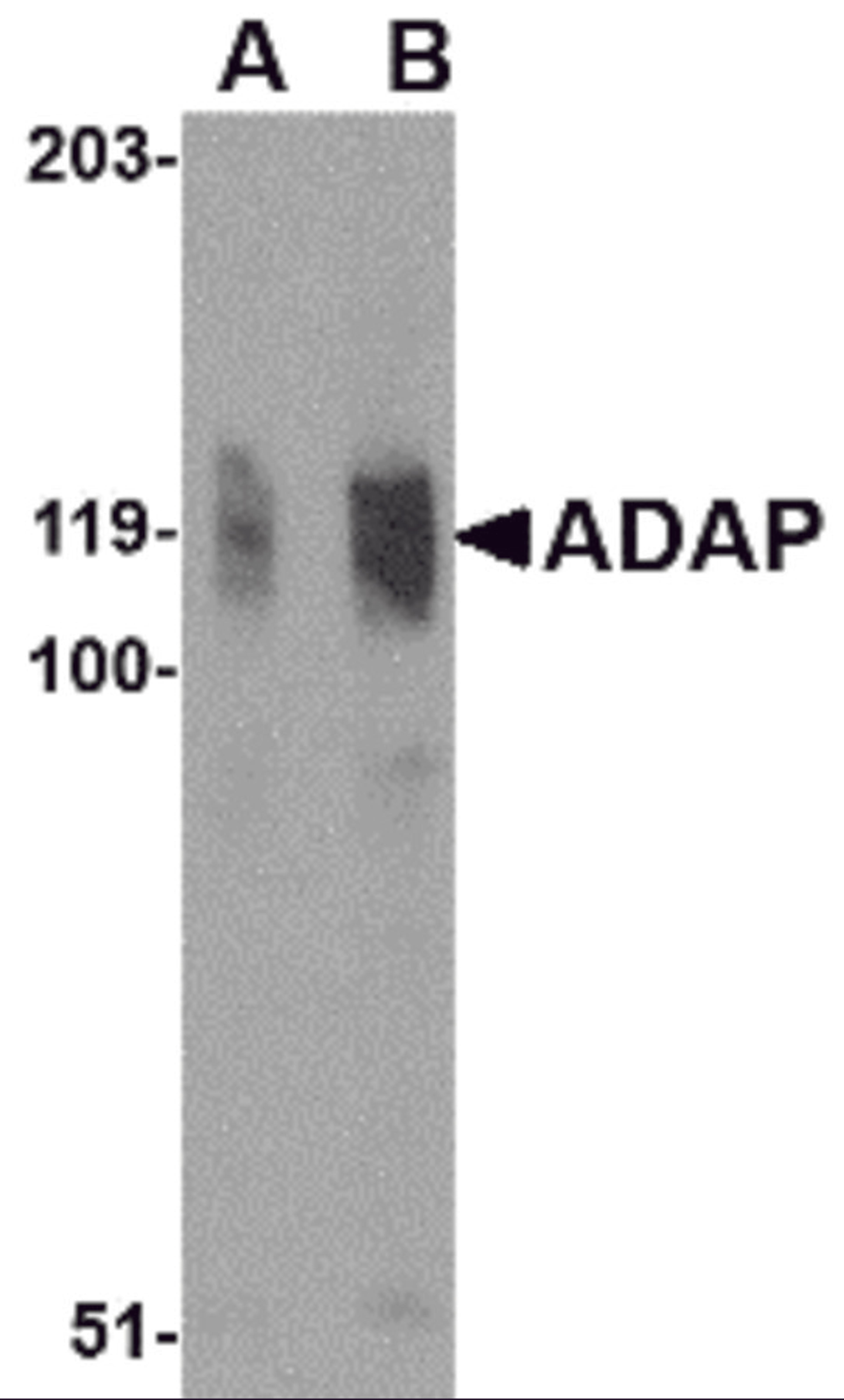 Western blot analysis of ADAP in K562 cell lysate with ADAP antibody at (A) 0.5 and (B) 1 μg/mL.