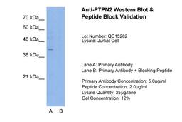 Antibody used in WB on Jurkat 5.0 ug/ml (Lane A: Primary Antibody and Lane B: Primary Antibody + Blocking Peptide ).