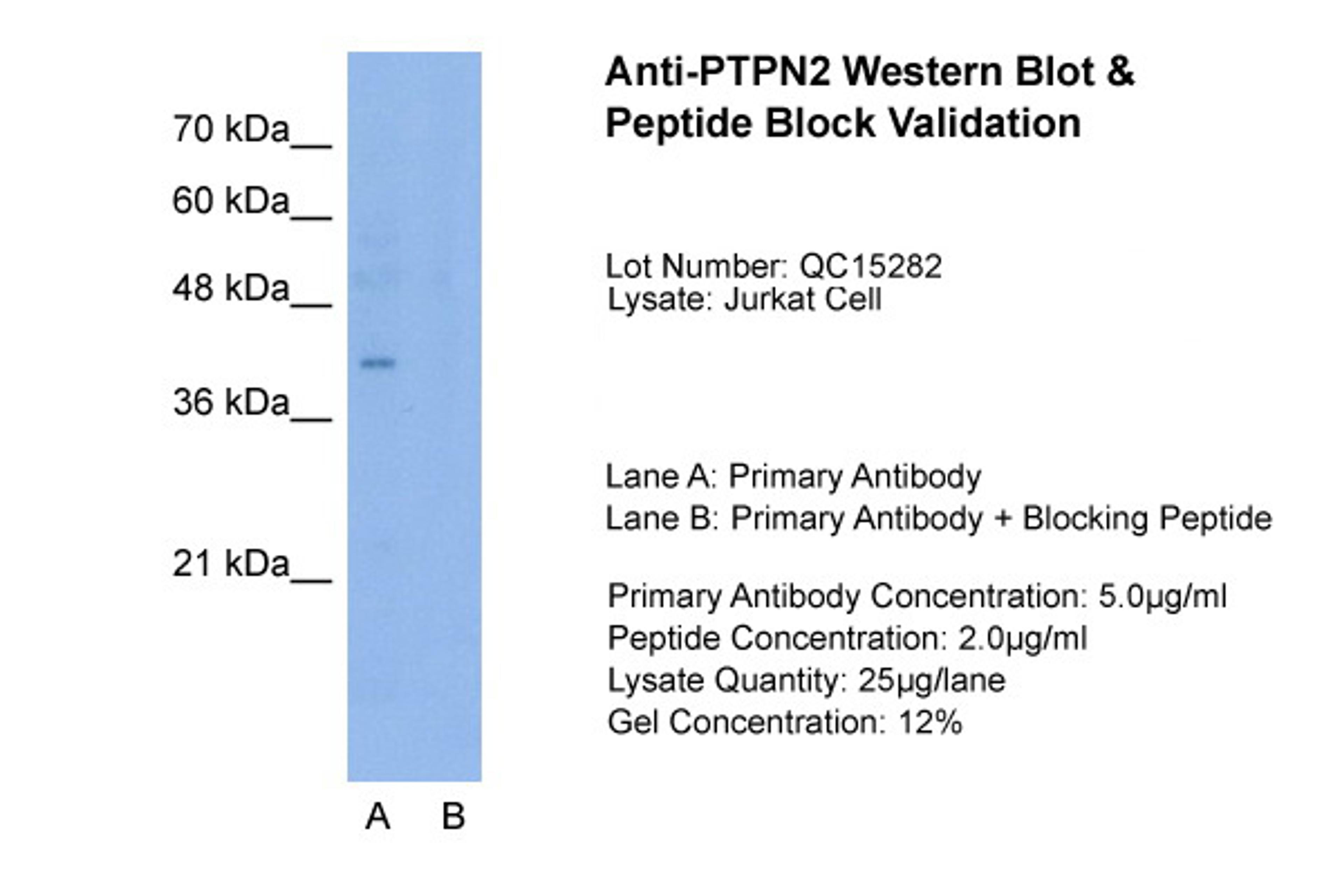 Antibody used in WB on Jurkat 5.0 ug/ml (Lane A: Primary Antibody and Lane B: Primary Antibody + Blocking Peptide ).