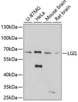 Western blot - LGI1 antibody (A5408)