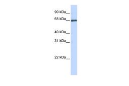 Antibody used in WB on Human Jurkat 0.2-1 ug/ml.