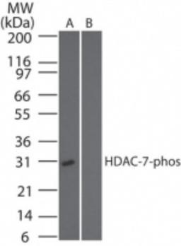 Western Blot: HDAC7 [p Ser318] Antibody [NBP2-03978] - Western blot analysis of phospho HDAC7 in (A) recombinant fusion protein containing a phosphorylated serine at position 318 and (B) fusion protein containinugan unphosphorylated serine at position 318, using HDAC7 phospho antibody at 0.1 ug/ml.