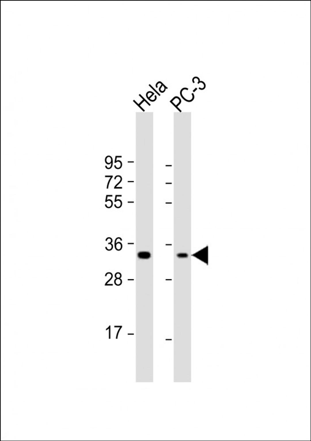 Western Blot at 1:1000 dilution Lane 1: Hela whole cell lysate Lane 2: PC-3 whole cell lysate Lysates/proteins at 20 ug per lane.