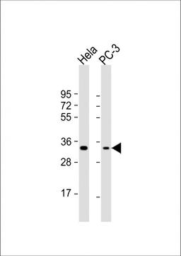 Western Blot at 1:1000 dilution Lane 1: Hela whole cell lysate Lane 2: PC-3 whole cell lysate Lysates/proteins at 20 ug per lane.