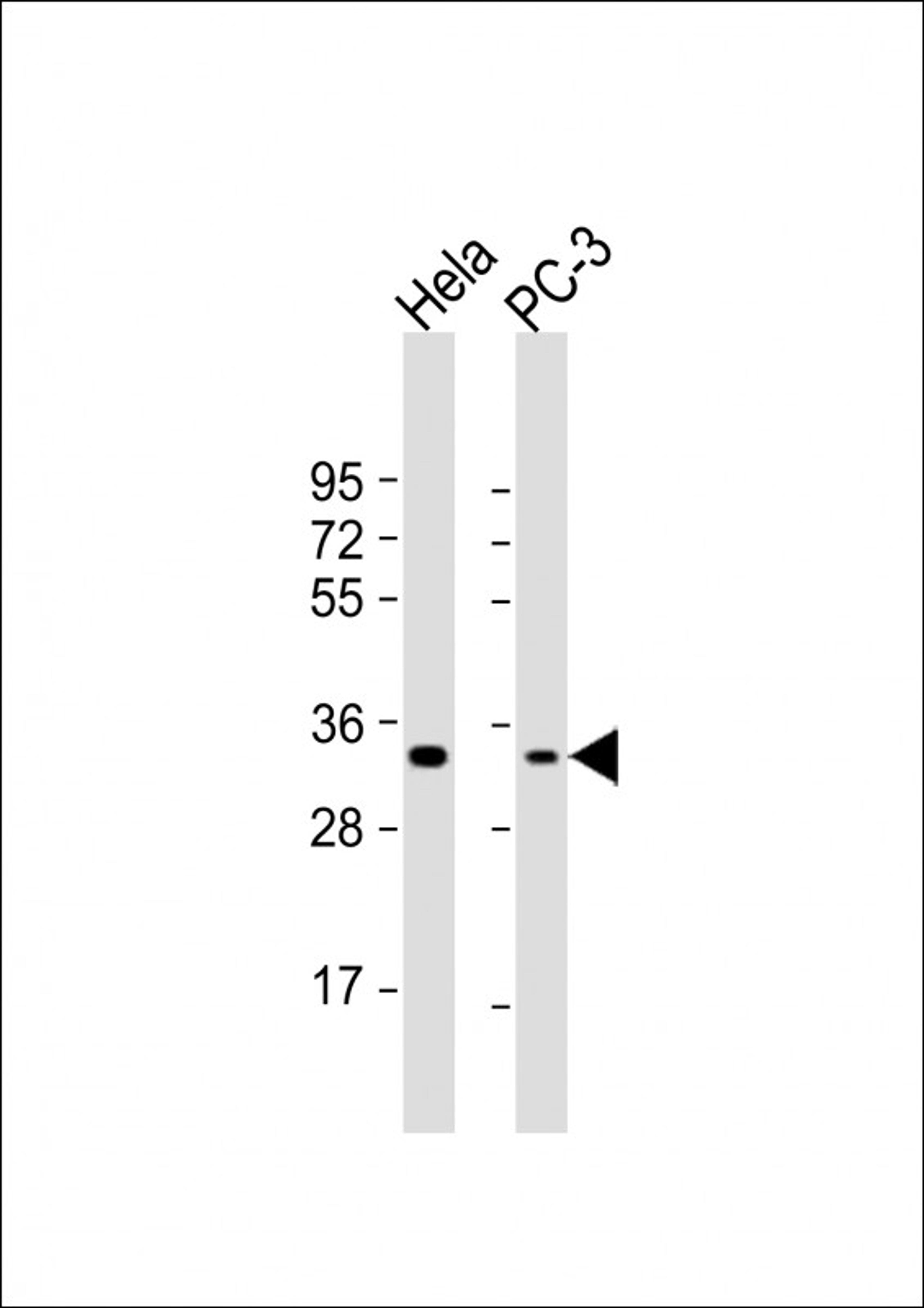 Western Blot at 1:1000 dilution Lane 1: Hela whole cell lysate Lane 2: PC-3 whole cell lysate Lysates/proteins at 20 ug per lane.