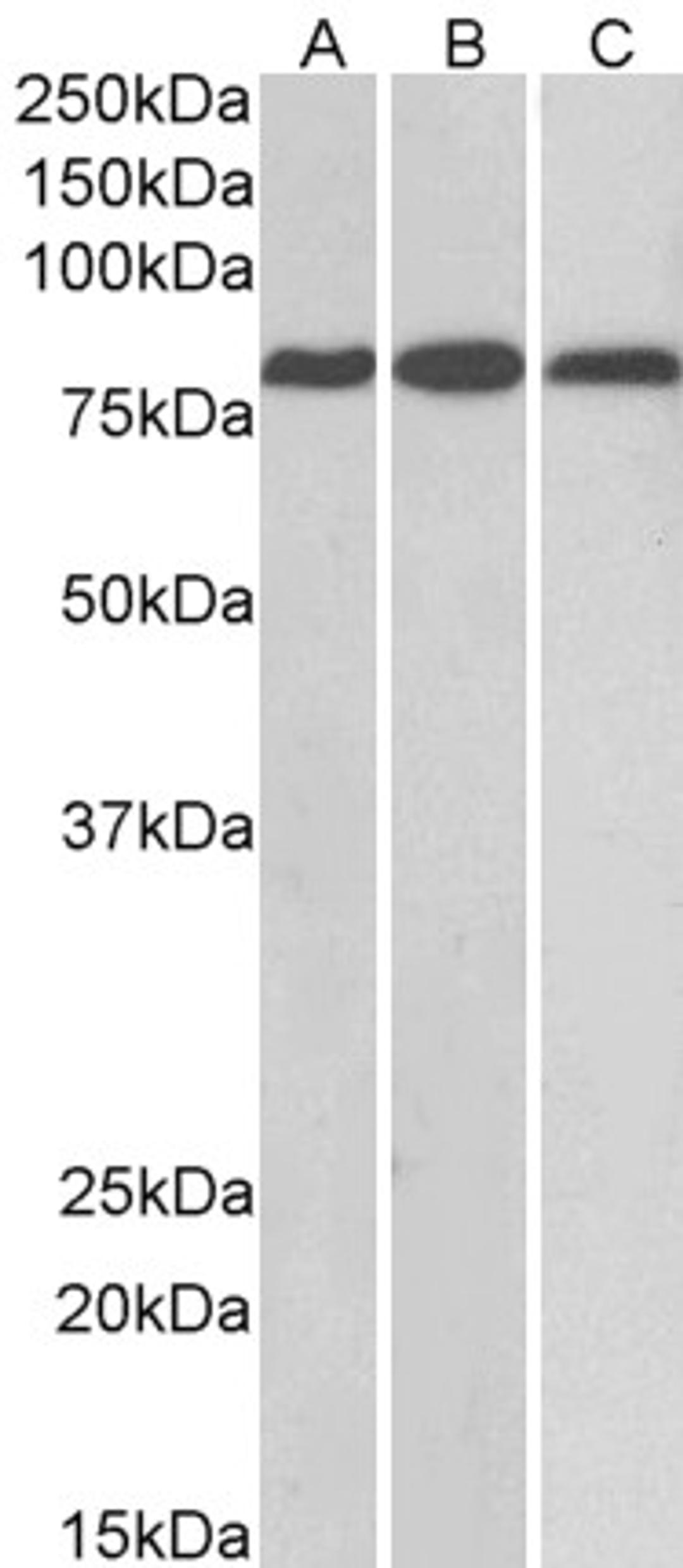 45-887 (0.1ug/ml) staining of Mouse (A) and Rat (B) Heart, and Rat Kidney (C) lysates (35ug protein in RIPA buffer). Primary incubation was 1 hour. Detected by chemiluminescence.