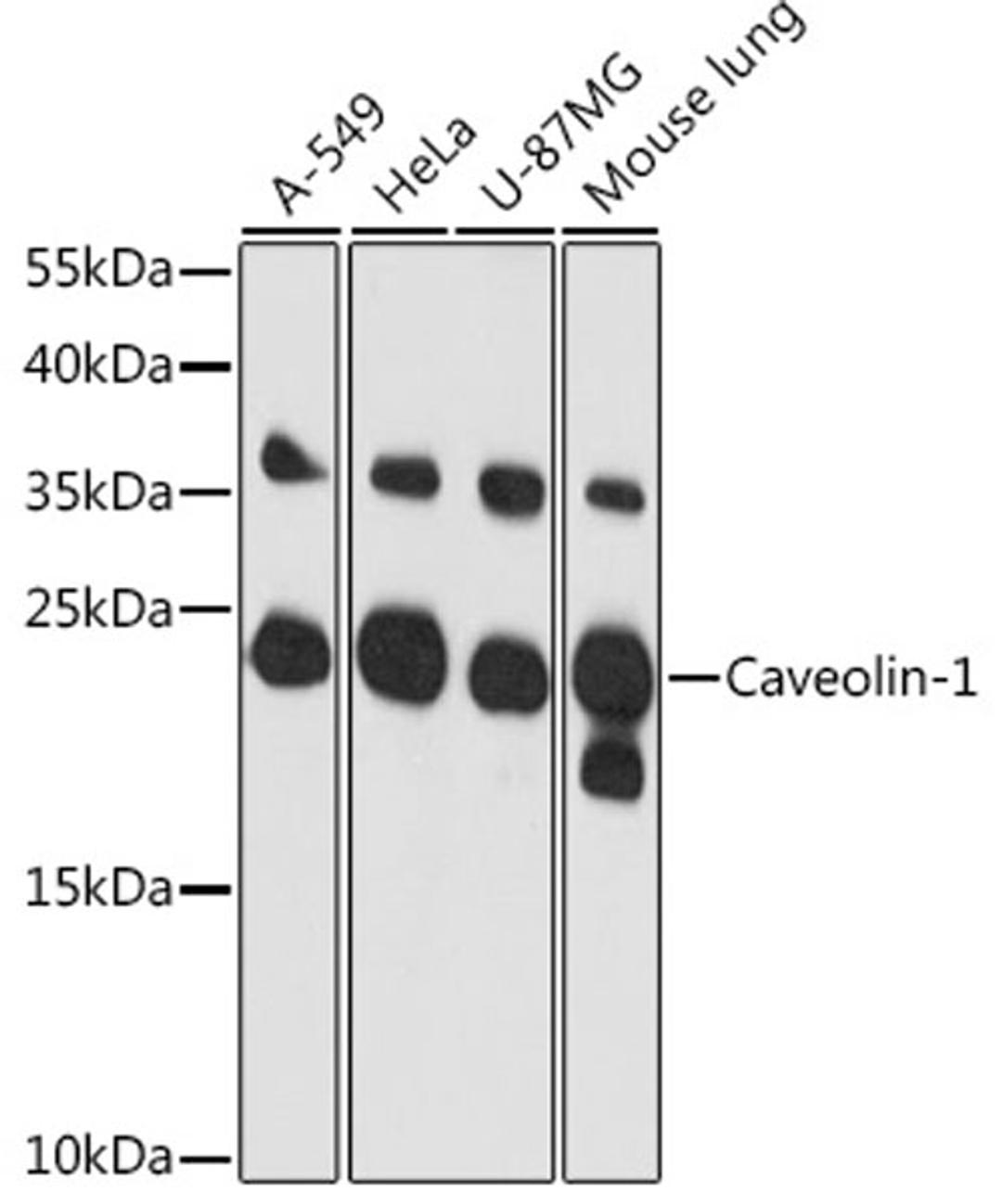 Western blot - Caveolin-1 antibody (A1555)