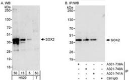 Detection of human SOX2 by western blot and immunoprecipitation.