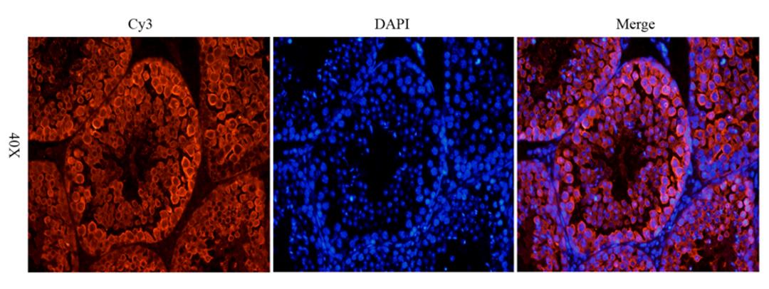 IF analysis of mouse testis tissue using Stathmin antibody (dilution of primary antibody at 1:100)