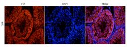 IF analysis of mouse testis tissue using Stathmin antibody (dilution of primary antibody at 1:100)